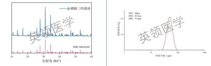 XRD pattern and particle size distribution chart